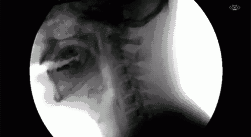 tumblr_miykvby5VN1qldr5ko1_500